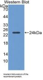 Alpha-1-Acid Glycoprotein (a1AGP) Antibody
