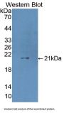 Coagulation Factor VII (F7) Antibody