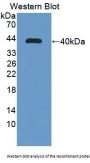 Apolipoprotein C-I (APOC1) Antibody