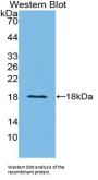 Transthyretin (TTR) Antibody