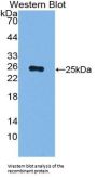 Alpha-1-Acid Glycoprotein 1 (ORM1) Antibody