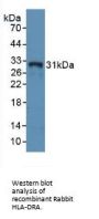 HLA Class II Histocompatibility Antigen, DR Alpha Chain (HLA-DRA) Antibody