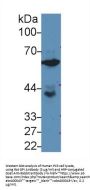 Glucose 6 Phosphate Isomerase (GPI) Antibody