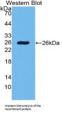 Glucose 6 Phosphate Isomerase (GPI) Antibody