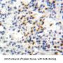 Glucose 6 Phosphate Isomerase (GPI) Antibody