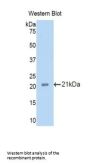 Podocin / PDCN (NPHS2) Antibody