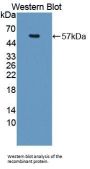 Nucleoporin 50 kDa (NUP50) Antibody