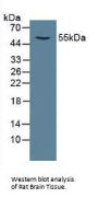 Calcium/Calmodulin Dependent Protein Kinase II Alpha (CAMK2a) Antibody