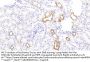 11 beta Hydroxysteroid Dehydrogenase Type 2 Antibody