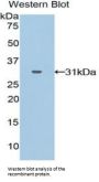 GRB2 Related Adaptor Protein 2 (GRAP2) Antibody