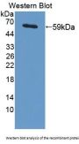 Inter Alpha-Globulin Inhibitor H1 (ITIH1) Antibody
