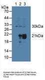 Cytoglobin Antibody