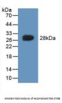 Cytoglobin Antibody