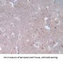 Cytoglobin Antibody
