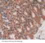 TEK Tyrosine Kinase, Endothelial Antibody