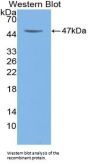 Colony Stimulating Factor 2, Granulocyte Macrophage (GMCSF) Antibody