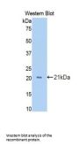 Growth Arrest Specific Protein 6 (GAS6) Antibody