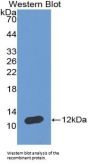 Atrial Natriuretic Peptide (ANP) Antibody