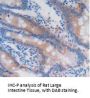 Glutathione S Transferase alpha 4 Antibody