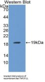 Tumor Necrosis Factor Ligand Superfamily Member 11 (TNFSF11) Antibody