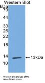 Polymeric Immunoglobulin Receptor (PIGR) Antibody