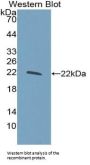 Glucokinase Regulatory Protein (GKRP) Antibody