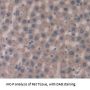 Glucokinase Regulatory Protein (GKRP) Antibody