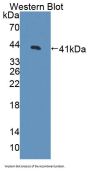Cyclin Dependent Kinase 2 (CDK2) Antibody