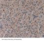 Cyclin Dependent Kinase 2 (CDK2) Antibody