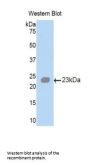 Angiopoietin-Related Protein 2 (ANGPTL2) Antibody
