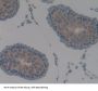 Angiopoietin-Related Protein 2 (ANGPTL2) Antibody