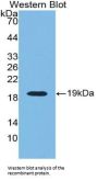 Renalase (RNLS) Antibody