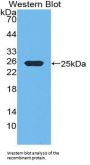Somatotropin / Growth Hormone (GH1) Antibody