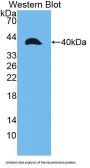 Matrix Metalloproteinase 23A (MMP23A) Antibody