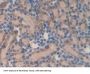 Matrix Metalloproteinase 23A (MMP23A) Antibody