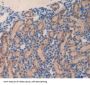 Matrix Metalloproteinase 23A (MMP23A) Antibody