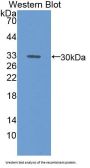 Microtubule Associated Protein 1A (MAP1A) Antibody