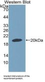 Growth Differentiation Factor 9 (GDF9) Antibody