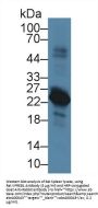 Pre-B-Lymphocyte Gene 1 (VPREB1) Antibody