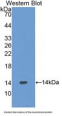 Pre-B-Lymphocyte Gene 1 (VPREB1) Antibody