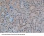 Pre-B-Lymphocyte Gene 1 (VPREB1) Antibody