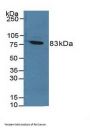 Coagulation Factor XIII A1 Polypeptide (F13A1) Antibody
