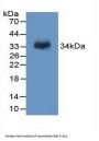 Coagulation Factor XIII A1 Polypeptide (F13A1) Antibody
