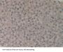 Coagulation Factor XIII A1 Polypeptide (F13A1) Antibody