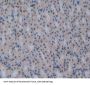 Coagulation Factor XIII A1 Polypeptide (F13A1) Antibody