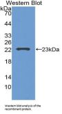 Glucagon Antibody