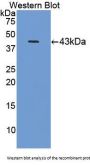 Complement Component 8b Antibody