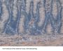 Complement Component 8b Antibody