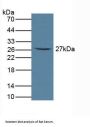Fc Fragment Of IgA Receptor / CD89 (FCAR) Antibody