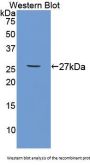 Tumor Necrosis Factor Receptor Superfamily Member 1B / CD120b (TNFRSF1B) Antibody